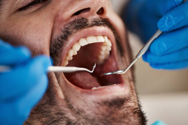 Best Emergency Treatment for Dental Infections or Abscesses in Bella Vista, AR