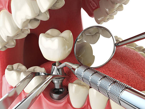 Best Emergency Dental Care for Broken or Chipped Teeth in Bella Vista, AR